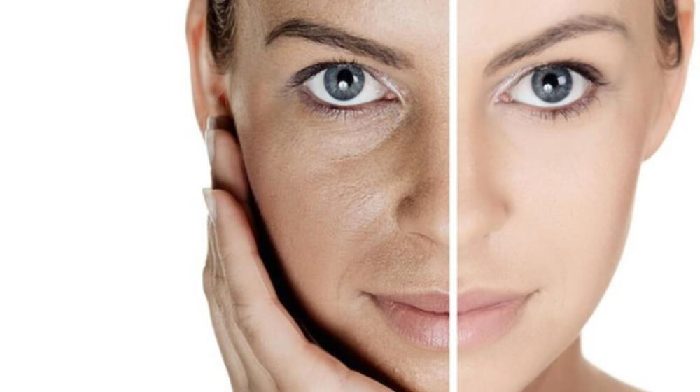 त्वचा बेजान क्यों हो जाती है? इसका कैसे उपचार किया जा सकता है?