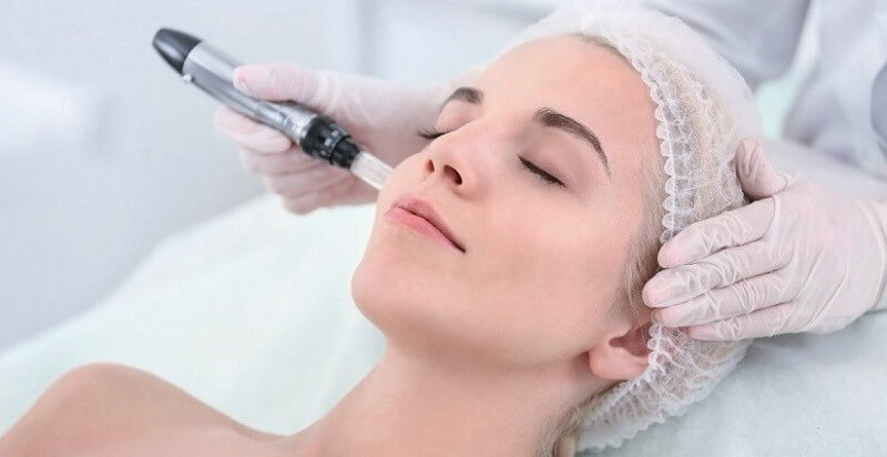 Micro-Needling (Pros And Cons) - Things You Should Know Before Trying This