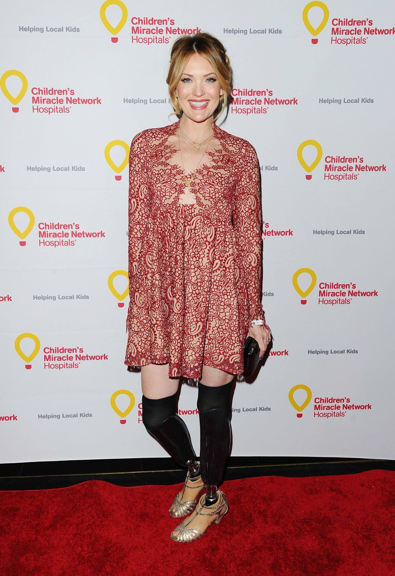 Amy Purdy   In Red Lace Design Full Sleeves  Short Dress At Children’s Miracle Network Hospitals’ Winter Wonderland Ball in Hollywood